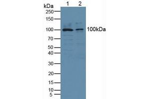 Detection of Recombinant cPLA2, Human using Polyclonal Antibody to Cytosolic Phospholipase A2 (PLA2G4) (PLA2G4A Antikörper  (AA 563-749))