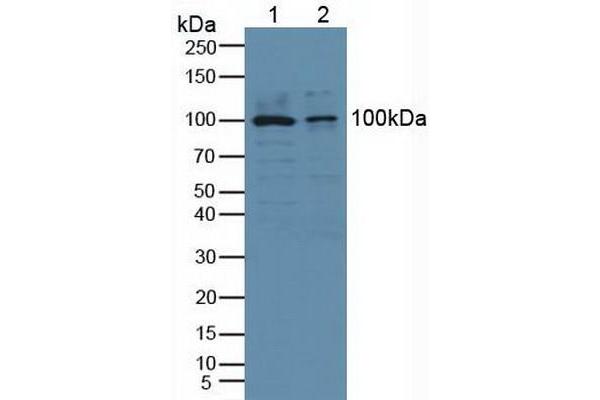 PLA2G4A Antikörper  (AA 563-749)