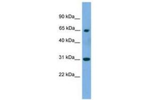 Image no. 1 for anti-Polynucleotide Kinase 3'-Phosphatase (PNKP) (AA 359-408) antibody (ABIN6744968) (PNKP Antikörper  (AA 359-408))