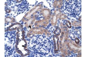 RGS13 antibody was used for immunohistochemistry at a concentration of 4-8 ug/ml to stain Epithelial cells of renal tubule (arrows) in Human Kidney. (RGS13 Antikörper  (Middle Region))