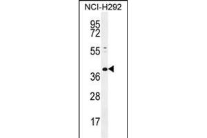 KCTD2 Antibody (C-term) (ABIN655466 and ABIN2844993) western blot analysis in NCI- cell line lysates (35 μg/lane). (KCTD2 Antikörper  (C-Term))