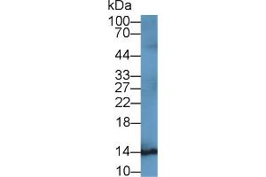 Detection of S100B in Rat Cerebrum lysate using Monoclonal Antibody to S100 Calcium Binding Protein B (S100B) (S100B Antikörper  (AA 1-92))