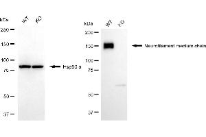 Western blotting analysis using neurofilament medium chain antibody (ABIN7800956). (Rekombinanter Neurofilament Medium Chain Antikörper)