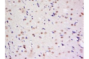 Formalin-fixed and paraffin embedded rat brain labeled with Anti-Dymeclin Polyclonal Antibody, Unconjugated  at 1:200 followed by conjugation to the secondary antibody and DAB staining. (Dymeclin Antikörper  (AA 151-250))