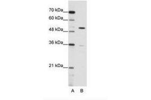 Image no. 1 for anti-Zinc Finger Protein 485 (ZNF485) (C-Term) antibody (ABIN6736173)