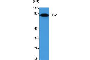 Western Blot (WB) analysis of specific cells using TYR Polyclonal Antibody. (TYR Antikörper  (C-Term))