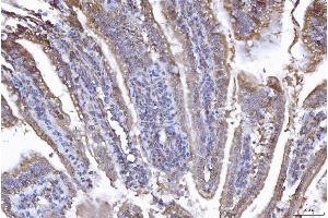 IHC analysis of EIF5A using anti-EIF5A antibody (ABIN7602568).