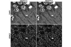 Array tomography immunofluorescence of 70 nm sections of LRWhite-embedded adult mouse hippocampus.