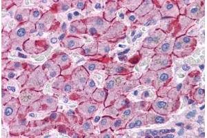 Immunohistochemistry (Formalin-fixed Paraffin-embedded Sections) (IHC (fp)) image for anti-Cadherin 1, Type 1, E-Cadherin (Epithelial) (CDH1) (AA 503-552) antibody (ABIN6745747)