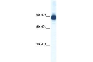WB Suggested Anti-ACTN2 Antibody Titration:  0. (ACTN2 Antikörper  (C-Term))