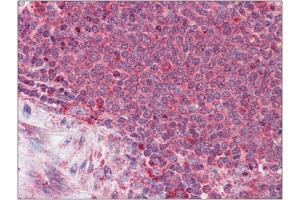Formalin-Fixed, Paraffin-Embedded Human Spleen stained with Thrombospondin-1 antibody at 3. (Thrombospondin 1 Antikörper  (N-Term))