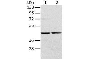 Western Blot analysis of Hepg2 and hela cell using RRAGA Polyclonal Antibody at dilution of 1:400 (RRAGA Antikörper)