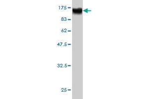 Western Blot detection against Immunogen (98. (RAP1GAP Antikörper  (AA 1-663))