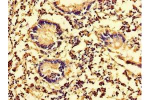 Immunohistochemistry of paraffin-embedded human appendix tissue using ABIN7157942 at dilution of 1:100 (Latexin Antikörper  (AA 1-216))