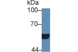 Western blot analysis of Human Serum, using Human HNF1b Antibody (5 µg/ml) and HRP-conjugated Goat Anti-Rabbit antibody ( (HNF1B Antikörper  (AA 159-300))