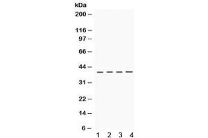 Western blot testing of 1) rat brain, 2) rat kidney, 3) mouse kidney and 4) human HeLa lysate with CSNK1A1 antibody. (CSNK1A1 Antikörper)