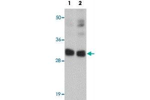 Western blot analysis of CCDC106 in human brain tissue lysate with CCDC106 polyclonal antibody  at (1) 0. (CCDC106 Antikörper  (C-Term))