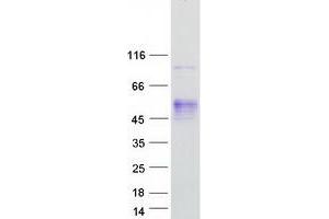 Validation with Western Blot