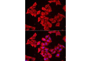 Immunofluorescence analysis of HeLa cell using SMPX antibody. (SMPX Antikörper)