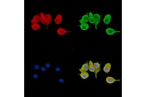 ABIN7095482 and ABIN7099539 staining Hela cells by IF/ICC. (SOCS4 Antikörper)