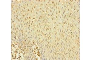 Immunohistochemistry of paraffin-embedded human tonsil tissue using ABIN7145012 at dilution of 1:100 (YME1L1 Antikörper  (AA 1-240))
