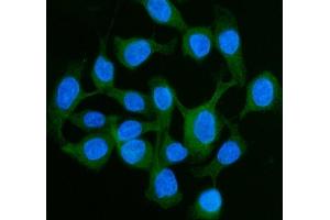 IF analysis of LI Cadherin/CDH17 using anti-LI Cadherin/CDH17 antibody (ABIN7600855).