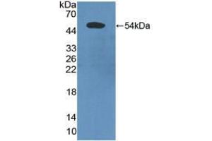 Western blot analysis of recombinant Human PDCD6IP. (ALIX Antikörper  (AA 174-383))