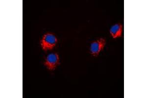 Immunofluorescent analysis of Paxillin staining in Hela cells. (Paxillin Antikörper  (N-Term))