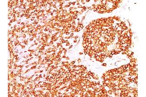 Formalin-fixed, paraffin-embedded human Tonsil stained with CD45RB Monoclonal Antibody (DF-B1). (CD45 Antikörper)