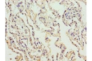 Immunohistochemistry of paraffin-embedded human lung tissue using ABIN7148251 at dilution of 1:100 (COL4a3 Antikörper  (AA 1427-1668))