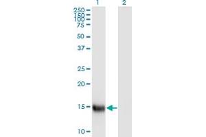 Western Blot analysis of SPEG expression in transfected 293T cell line by APEG1 monoclonal antibody (M01), clone S2. (SPEG Antikörper  (AA 1-113))