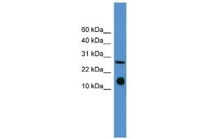 WB Suggested Anti-Il5 Antibody Titration: 0. (IL-5 Antikörper  (Middle Region))
