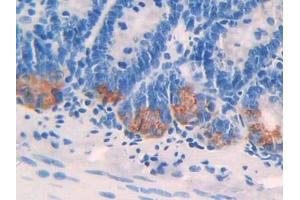 Detection of IL24 in Rat Intestine Tissue using Polyclonal Antibody to Interleukin 24 (IL24) (IL-24 Antikörper  (AA 29-183))