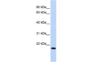 WB Suggested Anti-IRF7 Antibody Titration:  0. (IRF7 Antikörper  (N-Term))