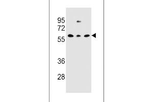 Western blot analysis in NCI-H460,293,MDA-MB231 cell line lysates (35ug/lane). (CLEC17A Antikörper  (C-Term))