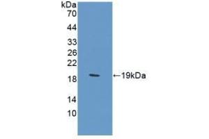 Detection of Recombinant CA12, Rat using Polyclonal Antibody to Carbonic Anhydrase XII (CA12) (CA12 Antikörper  (AA 154-307))