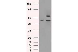 Image no. 2 for anti-Protein Phosphatase 5, Catalytic Subunit (PPP5C) antibody (ABIN1500391) (PP5 Antikörper)