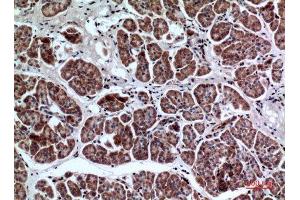 Immunohistochemistry (IHC) image for anti-Leukocyte Immunoglobulin-Like Receptor, Subfamily A (With TM Domain), Member 2 (LILRA2) (Internal Region) antibody (ABIN6281107)