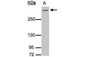 WB Image Sample (30μg whole cell lysate) A:Raji , 5% SDS PAGE antibody diluted at 1:3000 (MUC2 Antikörper  (C-Term))