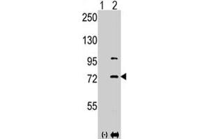 Western blot analysis of PAK1 (arrow) using PAK1 polyclonal antibody . (PAK1 Antikörper  (Thr423))