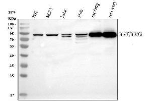 Western blot analysis of FOXO3A using anti-FOXO3A antibody (ABIN3042404). (FOXO3 Antikörper  (AA 471-673))