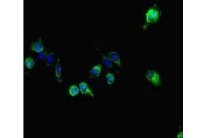 Immunofluorescent analysis of Hela cells using ABIN7163856 at dilution of 1:100 and Alexa Fluor 488-congugated AffiniPure Goat Anti-Rabbit IgG(H+L) (GALNT11 Antikörper  (AA 420-606))