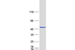 Western Blotting (WB) image for Chromosome 13 Open Reading Frame 31 (C13orf31) (Transcript Variant 2) protein (Myc-DYKDDDDK Tag) (ABIN2724449)