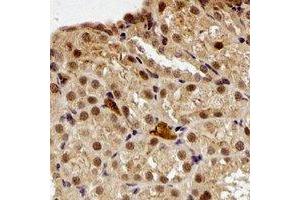 Immunohistochemical analysis of Periplakin staining in rat kidney formalin fixed paraffin embedded tissue section. (PPL Antikörper)