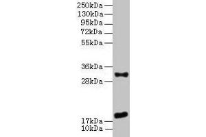 Western Blot All lanes: EMP3 antibody at 3 μg/mL + Mouse heart tissue Secondary Goat polyclonal to rabbit IgG at 1/10000 dilution Predicted band size: 19 kDa Observed band size: 19, 31 kDa (EMP3 Antikörper  (AA 25-65))