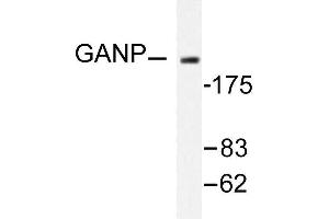 Image no. 1 for anti-Minichromosome Maintenance Complex Component 3 Associated Protein (MCM3AP) antibody (ABIN265431) (GANP Antikörper)