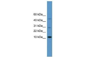 WB Suggested Anti-HMGA1 Antibody Titration:  0. (HMGA1 Antikörper  (N-Term))