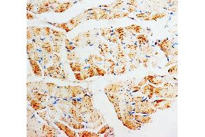 Anti-PMVK antibody, IHC(P) IHC(P): Rat Skeletal Muscle Tissue