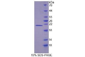 SDS-PAGE (SDS) image for Dystrophia Myotonica-Protein Kinase (DMPK) (AA 1-152) protein (His tag) (ABIN6239177)