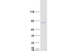 Western Blotting (WB) image for Src Kinase Associated Phosphoprotein 2 (SKAP2) protein (Myc-DYKDDDDK Tag) (ABIN2732105)